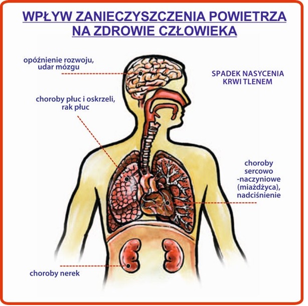 Powiększ grafikę. Grafika wpływ zanieszczyszenia powietrz na zdrowie człowieka